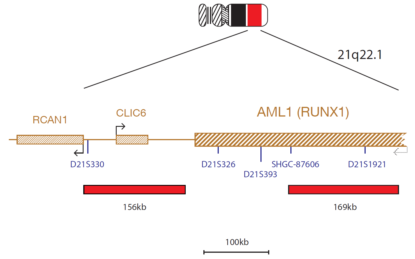 Fluorescence in situ hybridization (FISH) chromosome map showing a probe targeting the AML1 (RUNX1) gene.