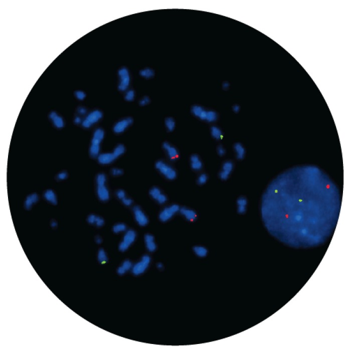 Fluorescence in situ hybridization (FISH) microscope image of the CytoCell IGH/cMYC Translocation, Dual Fusion probe.