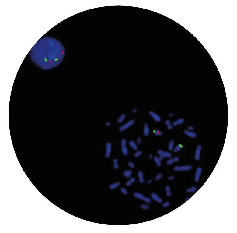 Fluorescence in situ hybridization (FISH) microscope image of the CytoCell D13S319 Plus Deletion probe.
