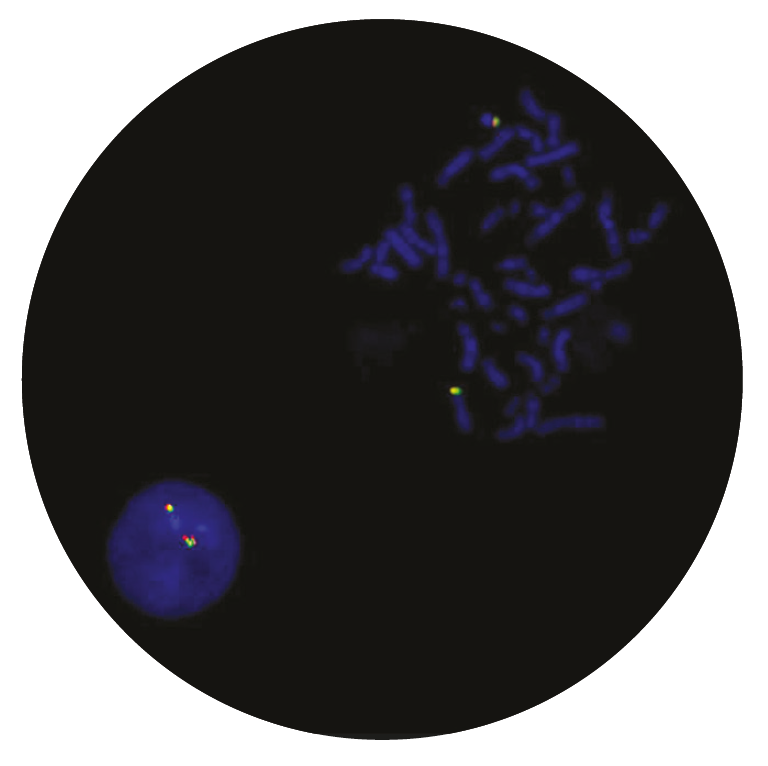 Fluorescence in situ hybridisation (FISH) microscope image of the CytoCell CRLF2 Breakapart probe.