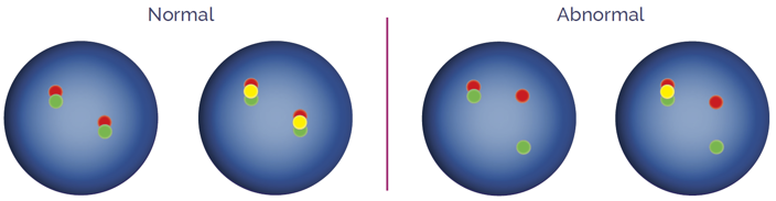 Dual-color breakapart probes