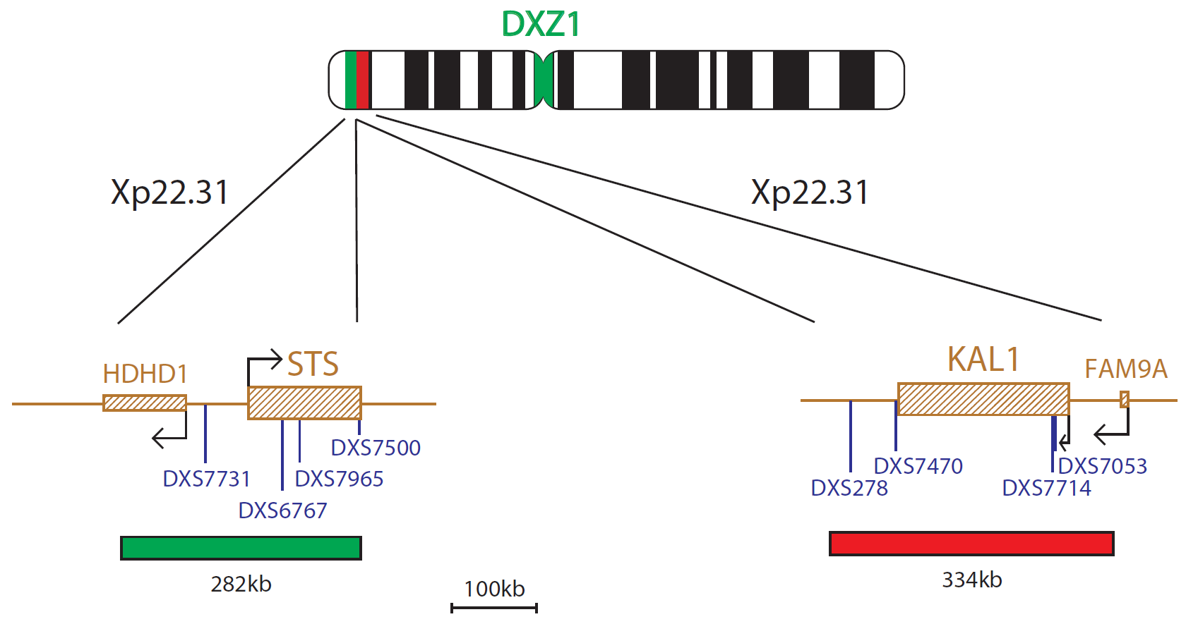 FISH chromosome map showing probes targeting regions associated with Kallmann syndrome (KAL1 gene) and STS.