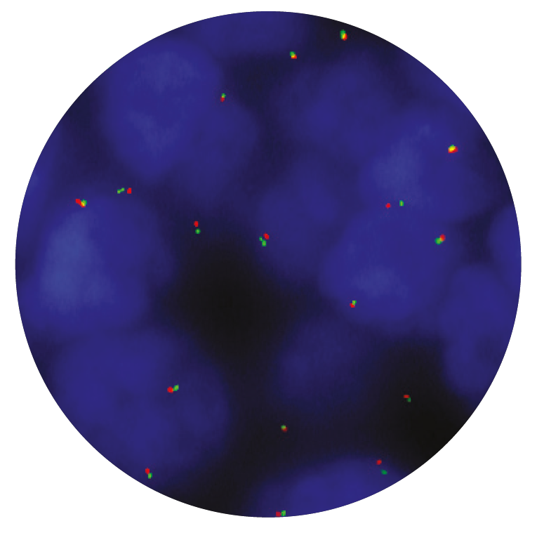 Fluorescence in situ hybridization (FISH) microscope image of the CytoCell MALT1 Breakapart probe.